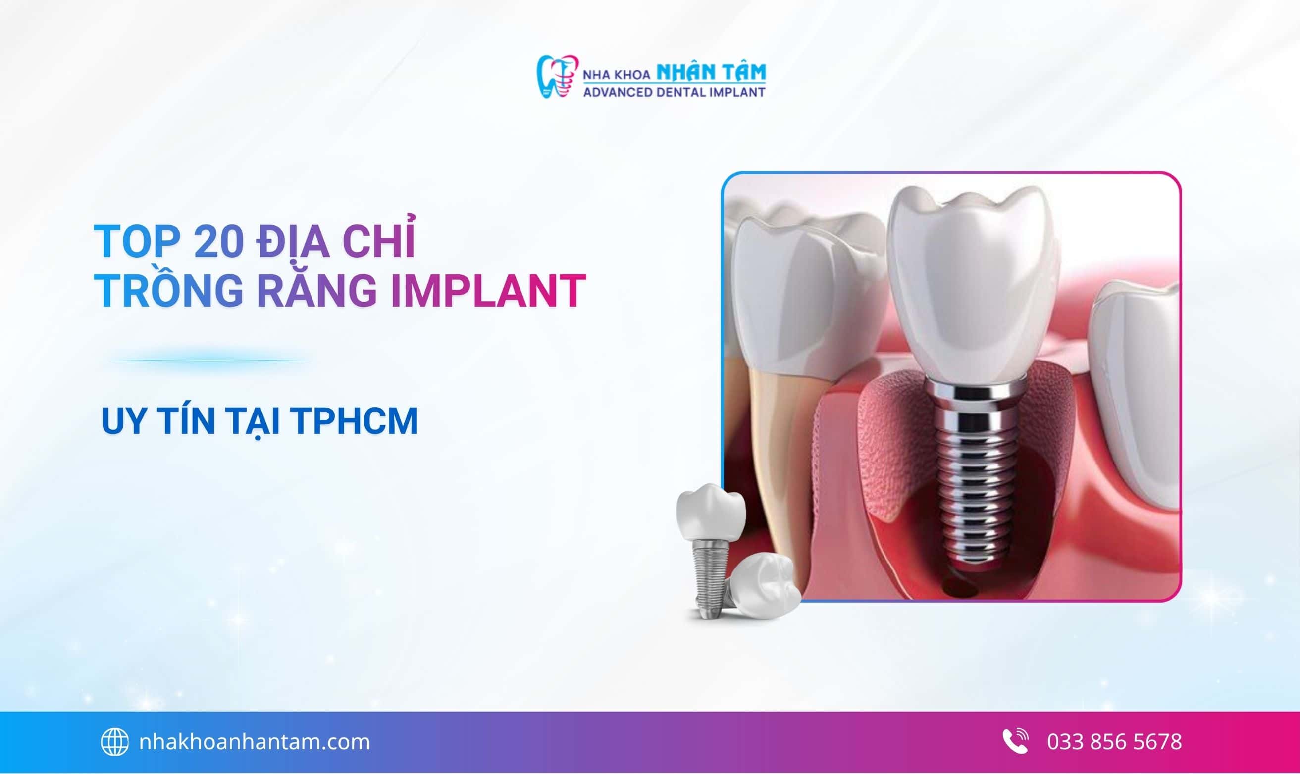 Hình: Top 20 Địa chỉ nha khoa trồng răng Implant uy tín tại TPHCM